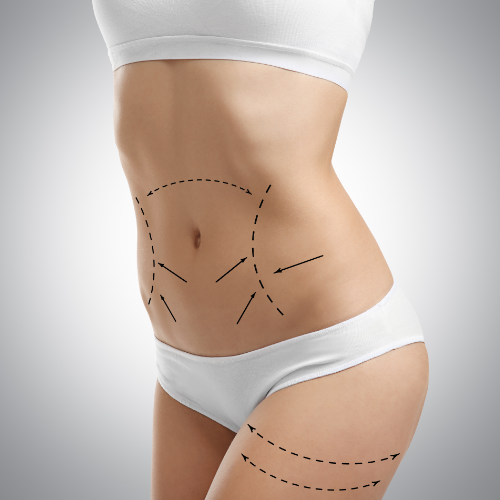 Laser Lipolysis *Laser Lipo*