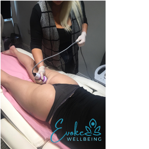 3 seesions Brazilian Bum Lift