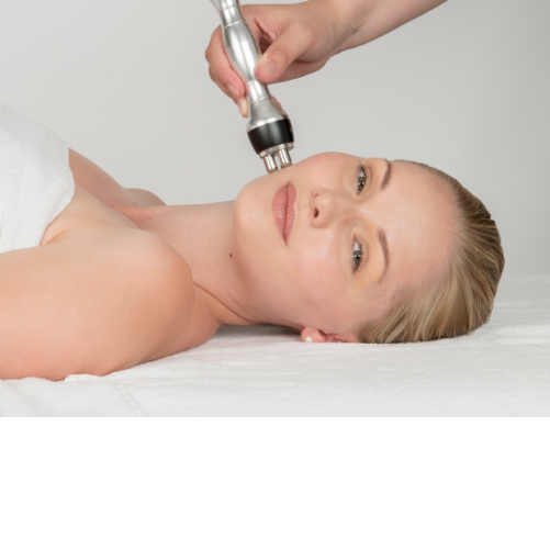 Radio-frequency (RF) Facial