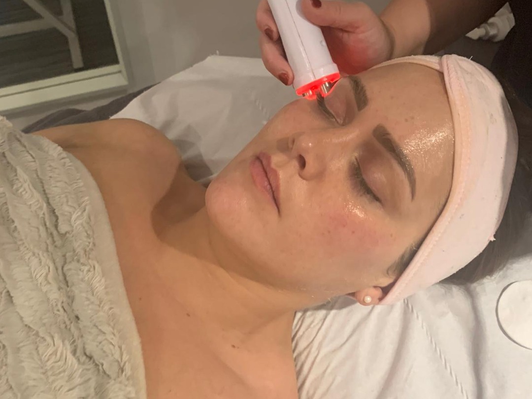 Non-Surgical Face Lift Non-Surgical Face Lift