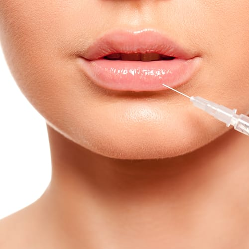 0.55ml Lip Filler