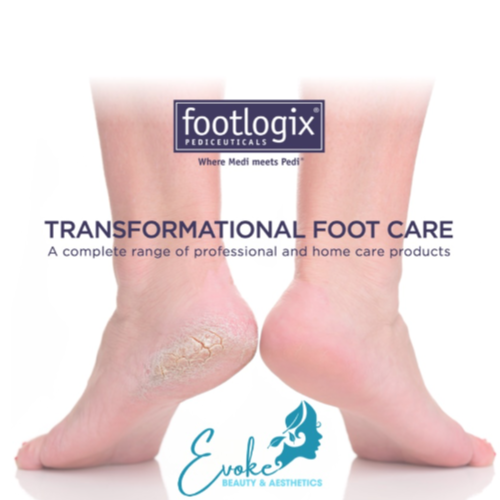 Footlogix Consultation