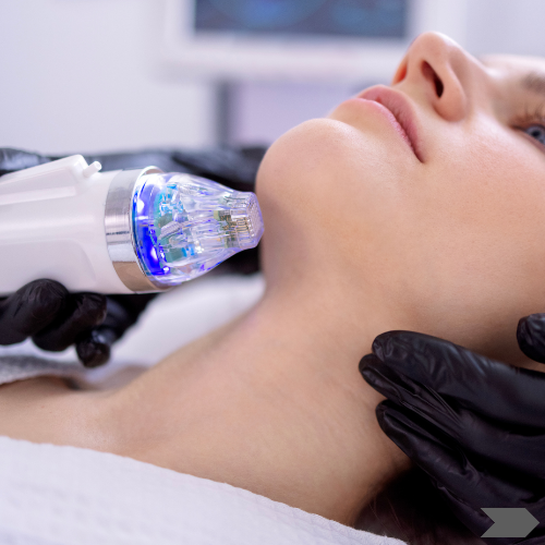 RF Microneedling