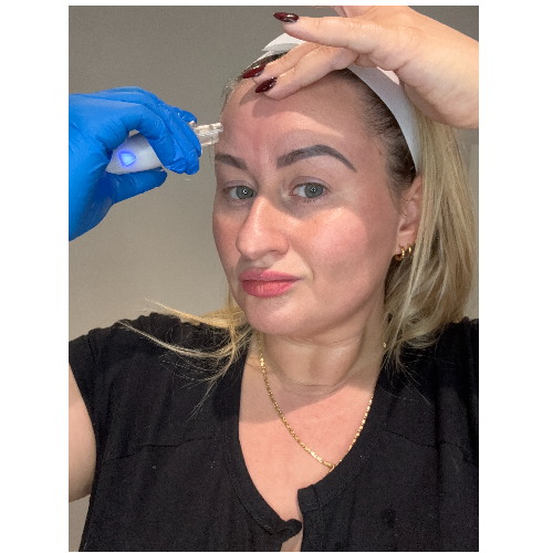 Hydra-Dermaplane Facial💆‍♀️💧Winter Skin Ready!