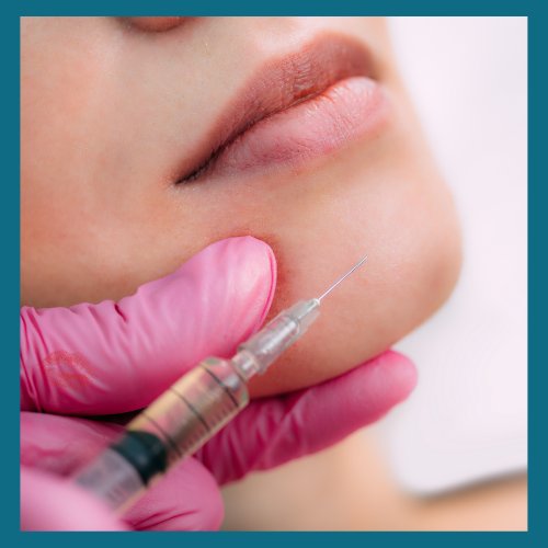 Lip Filler